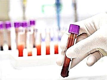 Detaljna uputstva o tome kako se testirati na glikovani hemoglobin