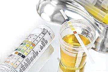 Diagnozoj de ketonuria: urina analizo por acetono, normoj kaj devioj