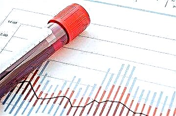 Norma hemoglobin glikét di diabetes mellitus sareng alesan panyimpang indikator analisis tina norma