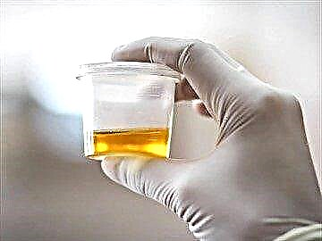 Hoeveel is die norm van suiker in urine: aanvaarbare glukose-waardes vir kinders, volwassenes en swanger vroue