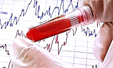 Ana materiale e analizës së hemoglobinës së glikuar: çmimi i spitalit shtetëror dhe laboratorëve privatë si Invitro, Hemotest, Helix dhe Sinevo