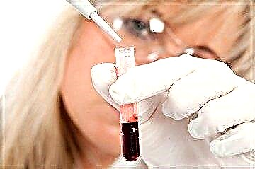 Suptilnosti pripreme za testove: kako donirati krv za šećer iz prsta i iz vene