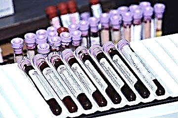 Naon hartosna hasil analisa pikeun gogosobil hemoglobin glycosylated: tambah indéks naék