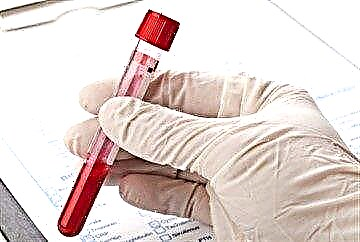 تعیین قند خون در پلاسما خون: هنجارها و دلایل انحراف
