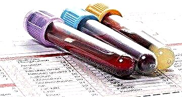 Проверете го тестот на крвта за шеќер кај деца: нормата и толкувањето на резултатите
