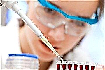 رمزگشایی آزمایش خون برای قند در بزرگسالان: هنجارهای موجود در جدول و دلایل انحراف