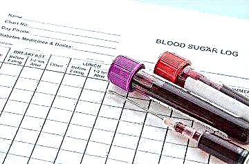 Envío dun exame de sangue para o azucre nun neno - desde a preparación ata descifrar os resultados
