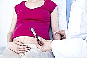 ორსულობის დროს შაქრის სისხლის ტესტირებას ვაძლევთ: ნორმები, გადახრების მიზეზები და ინდიკატორების კორექტირების მეთოდები