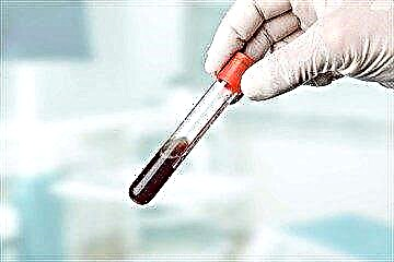 کیا عام خون کے ٹیسٹ میں شوگر کا ڈیکریپشن دکھاتا ہے: مطالعہ کی فزیبلٹی اور اس کے معمول