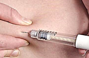 Kung saan mag-iniksyon ng insulin - mga panuntunan sa iniksyon