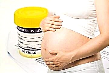 As principais causas da presenza de acetona nos ouriños de mulleres embarazadas, síntomas e métodos de tratamento