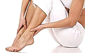 Dhimbje të dhimbshme të këmbëve në diabet - taktikat e trajtimit
