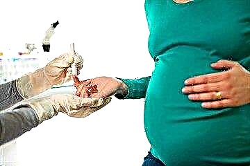دوره بارداری در دیابت: عوارض احتمالی و راه های پیشگیری از آنها