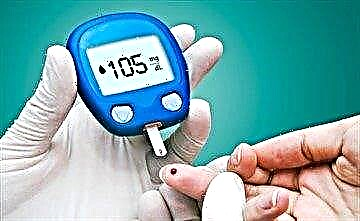 قند بالاتر از حد معمول است: علل فیزیولوژیکی و آسیب شناختی افزایش گلوکز در آزمایش خون