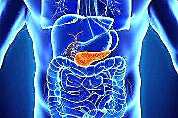 Pancreatitis a diabetes - a oes cysylltiad rhwng afiechydon a sut i'w trin ar yr un pryd?