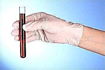 Analiz gloglobin emoglobin: nòmal la nan timoun yo, sa ki lakòz devyasyon nan endikatè ak metòd pou nòmalizasyon yo