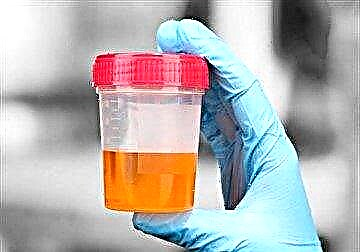 Analiz urin pou sik: nòmal la nan gason pa laj ak sa ki lakòz devyasyon