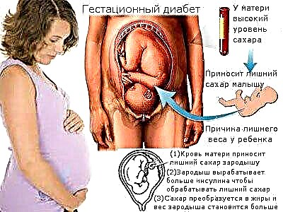 Bloedglukose tydens swangerskap