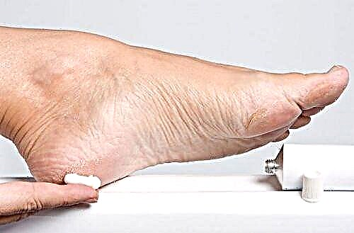Masti za stopala protiv dijabetesa