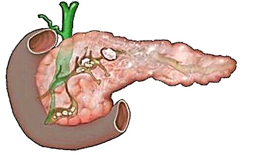 Pancreas keviran