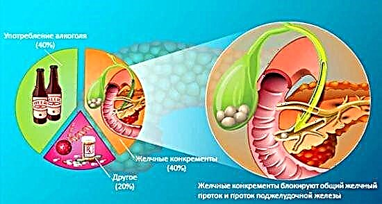 Mga Bati sa pancreatic