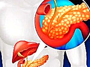 Ọrịa pancreatic na ụmụaka