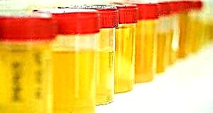 Enpòtans nan uriniz pou dystasis nan dyagnostik la nan maladi pankritik