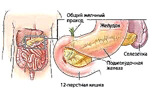 O mecanismo de desenvolvemento da pancreatopatía