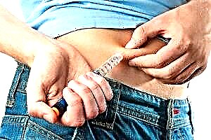 Tipoj de insulinoterapio por diabeto