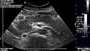 Daxuyaniya ultrasound ya pankreasê