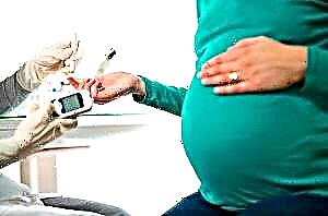 حاملہ خواتین میں بلڈ شوگر۔ معمول اور پیتھالوجی