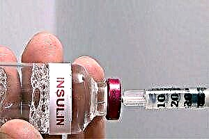 Ukubuka konke kwezinhlobo eziphambili ze-insulin nokuhlukaniswa kwazo