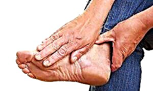 Причини и знаци на гангрена на стапалото кај дијабетес