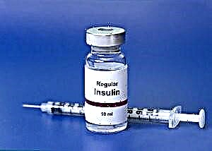 Qandli diabetda insulinni qabul qilish qoidalari va algoritmi