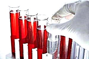 چه چیزی در آزمایش خون بیوشیمیایی گنجانده شده است و چه چیزی را نشان می دهد؟