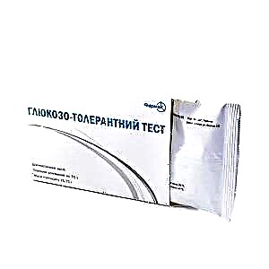 It-Test tat-Tolleranza tal-Glukożju (PTTG)