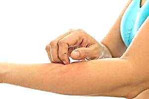 Причини и симптоми на чешање на кожата со дијабетес