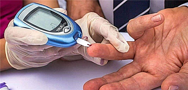 La ĉefaj metodoj por diagnozo de diabeto