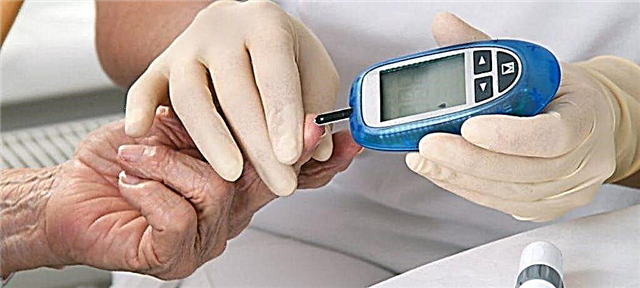 نحوه تعیین دیابت با پزشک و در خانه. علائم بیماری در حال توسعه