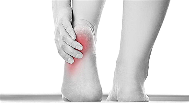რა იწვევს ფეხის ტკივილს დიაბეტში?