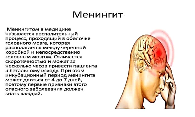 Головная боль при менингите. Локализация головной боли при менингите. Боль в шее при менингите.