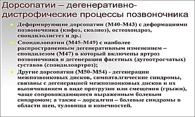 Код мкб дорсопатия поясничного отдела позвоночника