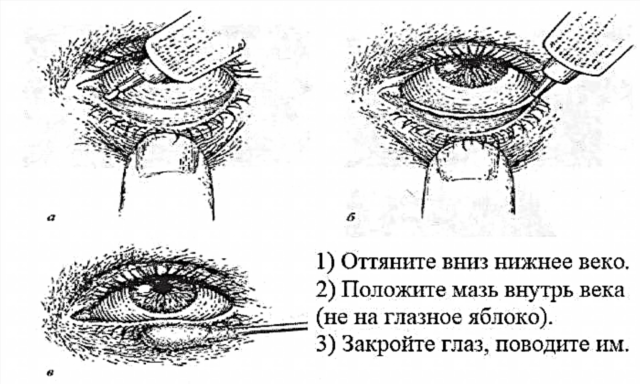 Массаж век при блефарите схема