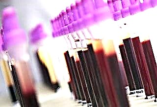 Kako dešifrirati biohemijski test krvi