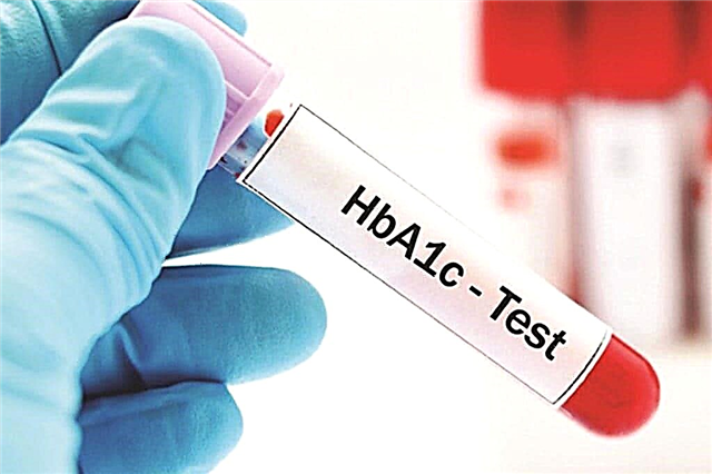 Глицирленген гемоглобинге талдау (HbA1c)